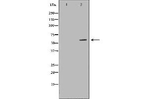 Image no. 1 for anti-Lymphocyte Cytosolic Protein 2 (SH2 Domain Containing Leukocyte Protein of 76kDa) (LCP2) (Internal Region) antibody (ABIN6262938)