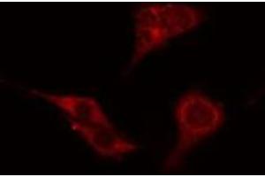 Image no. 2 for anti-Autophagy related 4C Cysteine Peptidase (ATG4C) antibody (ABIN6260106)