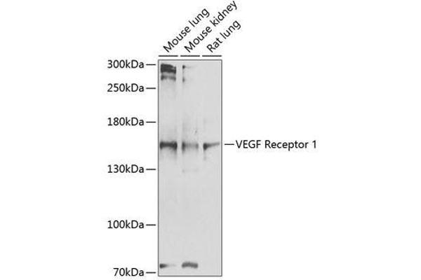 FLT1 抗体  (AA 20-300)