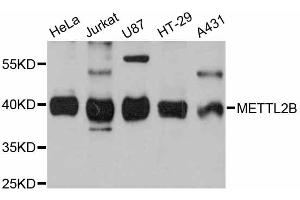 Image no. 1 for anti-Methyltransferase Like 2B (METTL2B) antibody (ABIN6290626)