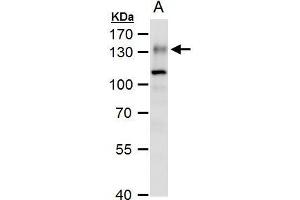 WB Image ENPP1 antibody [N2C2], Internal detects ENPP1 protein by western blot analysis.