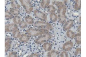 Image no. 2 for anti-Cathepsin H (CTSH) (AA 21-333) antibody (ABIN5013307)
