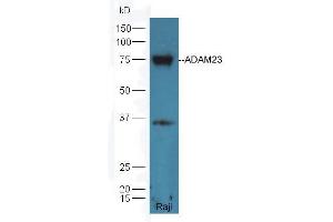 Image no. 1 for anti-ADAM Metallopeptidase Domain 23 (Adam23) (AA 551-650) antibody (ABIN758846)