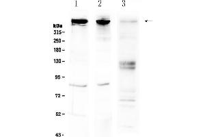 Image no. 1 for anti-Spastic Ataxia of Charlevoix-Saguenay (Sacsin) (SACS) (AA 3709-3909) antibody (ABIN5693301)