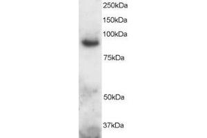 Image no. 1 for anti-ADAM Metallopeptidase Domain 8 (ADAM8) (C-Term) antibody (ABIN184726)
