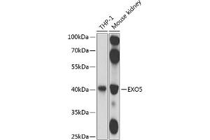 EXO5 抗体  (AA 1-373)