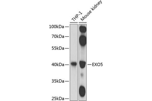 EXO5 抗体  (AA 1-373)