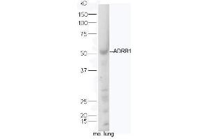 Image no. 5 for anti-Adrenergic, beta-1-, Receptor (ADRB1) (AA 181-250) antibody (ABIN669351)