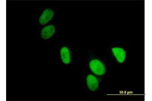 Immunofluorescence of purified MaxPab antibody to UBA2 on HeLa cell.