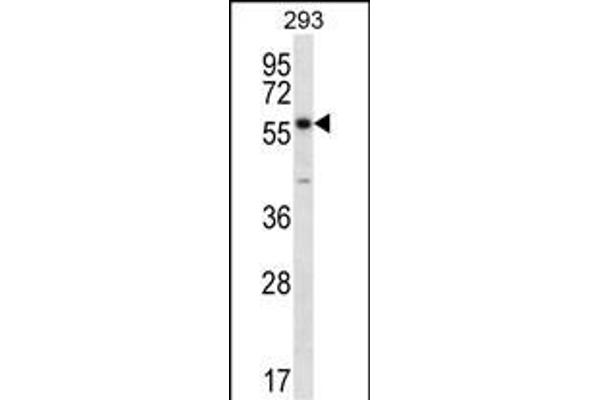 PNPLA1 antibody  (N-Term)