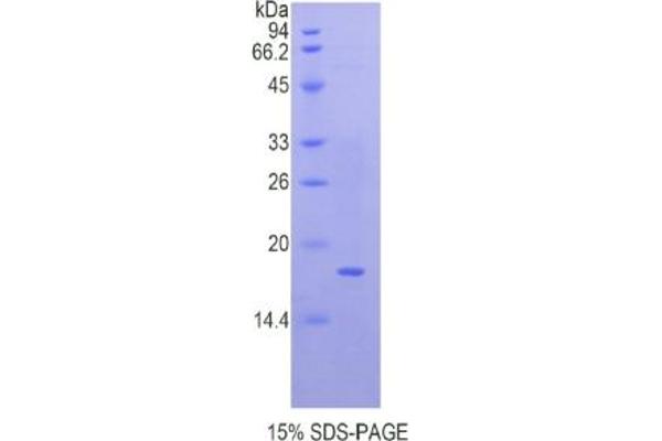 QSOX1 ELISA Kit