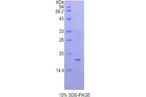 Image no. 1 for Quiescin Q6 Sulfhydryl Oxidase 1 (QSOX1) ELISA Kit (ABIN6574310)