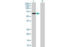 Image no. 1 for anti-Peripherin (PRPH) (AA 1-470) antibody (ABIN519307)