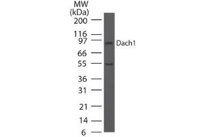 Image no. 2 for anti-Dachshund 1 (DACH1) (AA 474-491) antibody (ABIN960126)