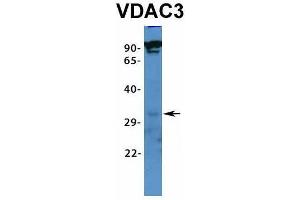 Image no. 2 for anti-Voltage-Dependent Anion Channel 3 (VDAC3) (N-Term) antibody (ABIN2776181)