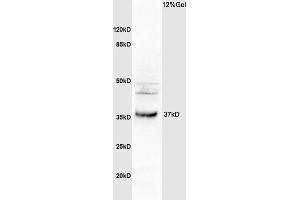 Image no. 1 for anti-Osteopetrosis Associated Transmembrane Protein 1 (OSTM1) (AA 21-120) antibody (ABIN1387308)