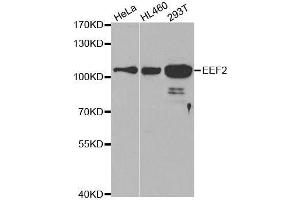 Image no. 3 for anti-Eukaryotic Translation Elongation Factor 2 (EEF2) antibody (ABIN3022843)