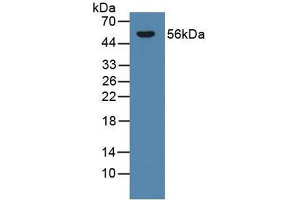 CYP21A2 antibody  (AA 106-389)