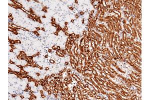 Image no. 3 for anti-Carbonic Anhydrase II (CA2) (AA 1-260) antibody (ABIN2001315)