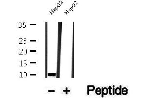 Image no. 1 for anti-Ubiquinol-Cytochrome C Reductase, Complex III Subunit VII, 9.5kDa (UQCRQ) (Internal Region) antibody (ABIN6265902)