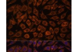 Immunofluorescence analysis of L929 cells using TLR3 Polyclonal Antibody at dilution of 1:100.