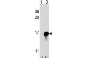 Image no. 2 for anti-FK506 Binding Protein 1A, 12kDa (FKBP1A) antibody (ABIN3003472)