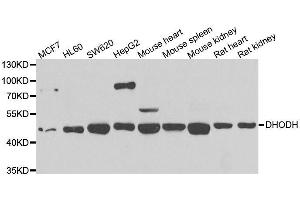 Image no. 1 for anti-Dihydroorotate Dehydrogenase (DHODH) antibody (ABIN6139588)