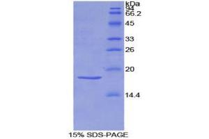 Image no. 1 for Sema Domain, Immunoglobulin Domain (Ig), Short Basic Domain, Secreted, (Semaphorin) 3A (SEMA3A) (AA 31-150) protein (His tag) (ABIN1877373)