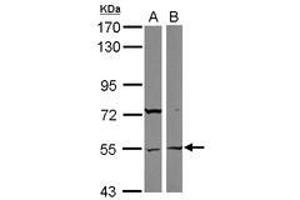 Image no. 1 for anti-Ankyrin Repeat and SOCS Box-Containing 3 (ASB3) (AA 197-433) antibody (ABIN1496739)