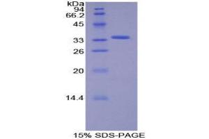 Image no. 1 for Salt-Inducible Kinase 2 (SIK2) (AA 655-925) protein (His tag) (ABIN1877625)