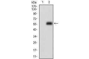 anti-Protein Phosphatase 1, Regulatory (Inhibitor) Subunit 1B (PPP1R1B) (AA 95-204) antibody