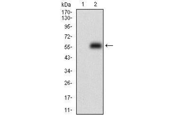anti-Protein Phosphatase 1, Regulatory (Inhibitor) Subunit 1B (PPP1R1B) (AA 95-204) antibody