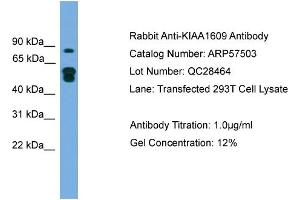 Image no. 2 for anti-MTOR associated protein, eak-7 homolog (MEAK7) (N-Term) antibody (ABIN2787248)