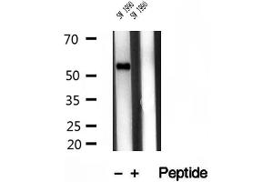 anti-Transmembrane Protease, serine 4 (TMPRSS4) (Internal Region) antibody