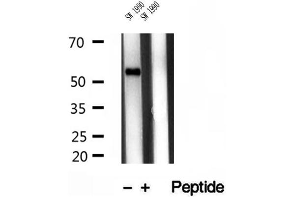 anti-Transmembrane Protease, serine 4 (TMPRSS4) (Internal Region) antibody
