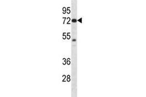 Image no. 4 for anti-P21-Activated Kinase 4 (PAK4) (AA 187-216) antibody (ABIN3032118)