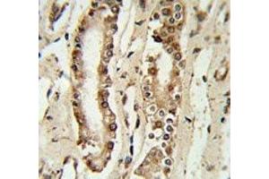 FOXP1 antibody IHC analysis in formalin fixed and paraffin embedded lung tissue.