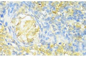 Immunohistochemistry of paraffin-embedded Rat ovary using HLA-DPB1 Polyclonal Antibody at dilution of 1:100 (40x lens).