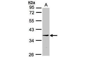 WB Image Sample (30μg whole cell lysate) A:H1299 10% SDS PAGE antibody diluted at 1:3000