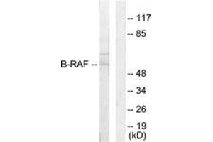 Image no. 1 for anti-Small Nuclear Ribonucleoprotein Polypeptide E (SNRPE) (AA 171-220) antibody (ABIN1533622)