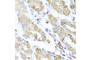 DARS2 anticorps  (AA 406-645)