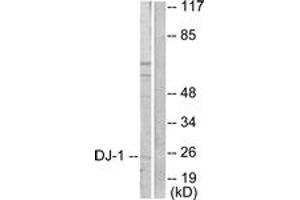 Image no. 3 for anti-Parkinson Protein 7 (PARK7) (AA 21-70) antibody (ABIN1533254)