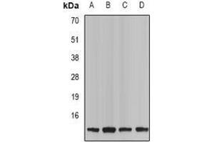 Image no. 2 for anti-Tachykinin 3 (TAC3) (full length) antibody (ABIN6005320)