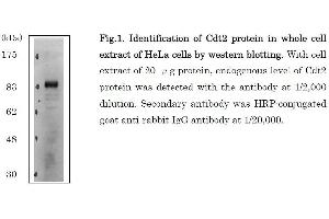 Image no. 6 for anti-Denticleless E3 Ubiquitin Protein Ligase Homolog (DTL) (C-Term) antibody (ABIN2451940)