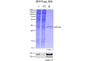 Image no. 1 for RFP-Trap® Magnetic Agarose (ABIN2452223)