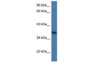 Image no. 1 for anti-Glucosamine-6-Phosphate Deaminase 1 (GNPDA1) (N-Term) antibody (ABIN928243)
