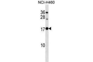Image no. 1 for anti-Ribosomal Protein L12 (RPL12) (AA 70-100), (Middle Region) antibody (ABIN954585)