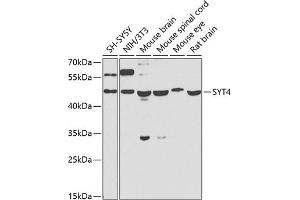 SYT4 抗体  (AA 38-190)