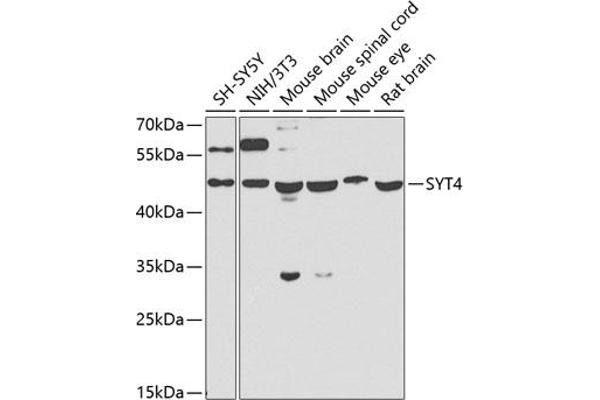 SYT4 抗体  (AA 38-190)