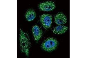 Image no. 2 for anti-Eosinophil Cationic Protein (ECP) (AA 124-151) antibody (ABIN657480)